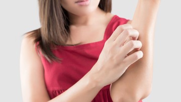 Wat is dermatitis herpetiformis?